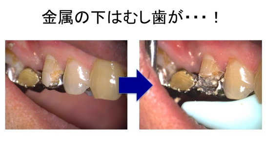 img20180115221136639646.jpg